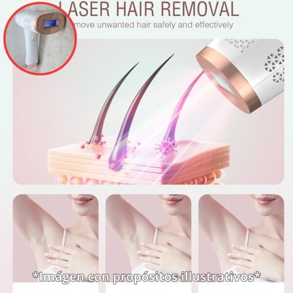 3 ✨ Depiladora Láser IPL con Sistema de Enfriamiento | 999,900+ Flashes | Grado A 🌸